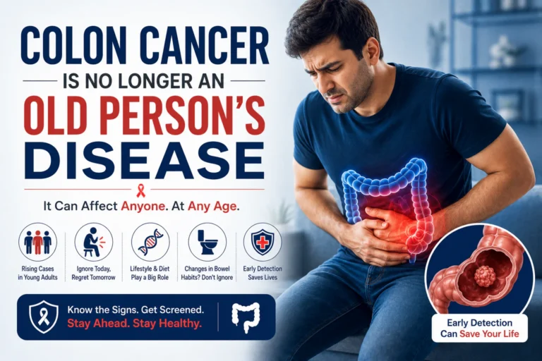 colon cancer