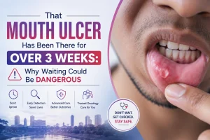 Mouth ulcer